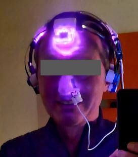 Brain PBM (Vielight)